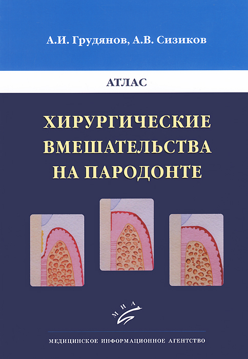 Хирургические вмешательства на пародонте. Атлас изменяется внимательно рассматривая