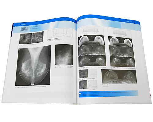 Маммография. 100 клинических случаев изменяется внимательно рассматривая